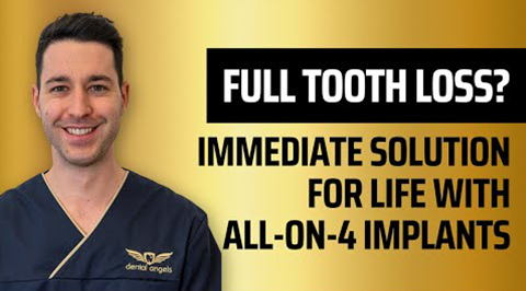 Instant solution up to full tooth loss? All-on-4 the immediate implantation! - video - dentalangels.hu