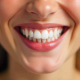 Felnottkent is lehet lathatatlanul szabalyos – Eva es a lathatatlan fogszabalyzo tortenete - dentalangels.hu