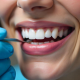 Tul sok fog, tul keves mosoly – az inyplasztika gyenged megoldas lehet - dentalangels.hu