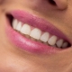 Direkt héj vagy porcelán héj – melyik a jobb választás - dentalangels.hu